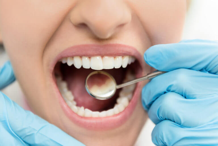 Hygiene check-up after dental implants