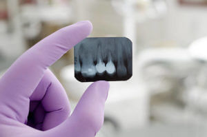 Doctor holding and looking at dental x-ray