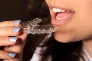 İnvisible braces