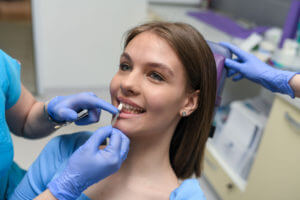 Dental veneers matching