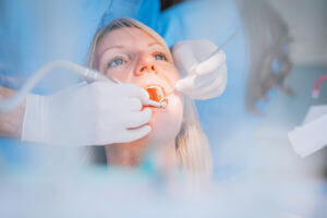 Close-up of a dental drill procedure at dentist