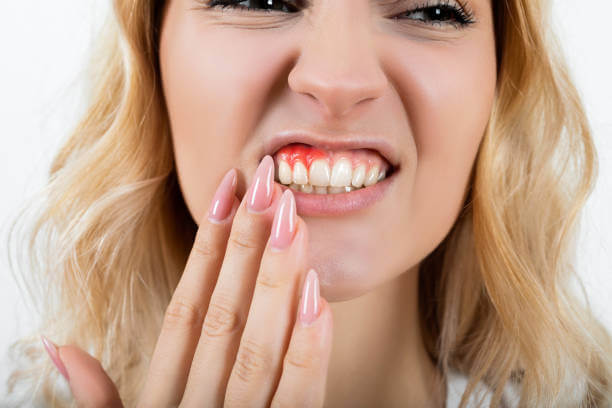 Young woman suffering from toothache