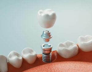 Dental care, modern clinic, 3d rendering, concept