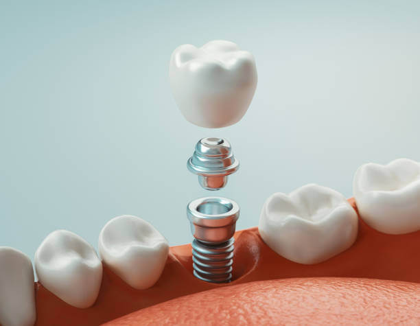Dental care, modern clinic, 3d rendering, concept