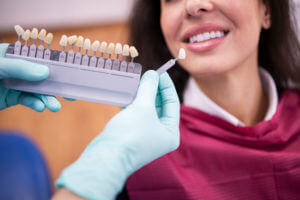 Dentist matching the right white tone for a dental crown