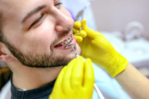 Man at the dentist braces check up