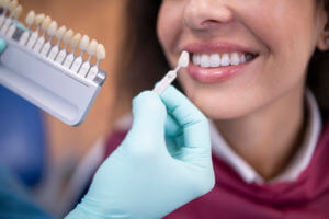 Dentist using a palette tooth color sample for dental implant