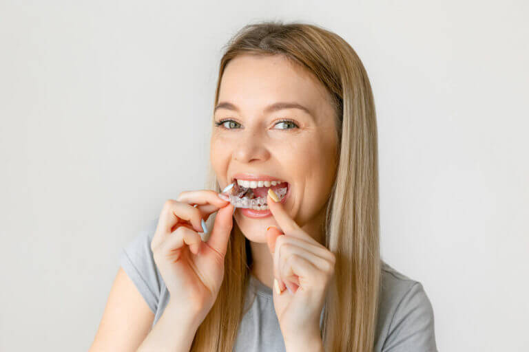 Teenage girl using invisible braces putting her clear aligners in her mouth.