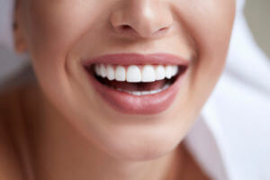 Woman with veneers smiling wide.