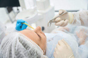 A woman in a dental chair preparing for a wisdom tooth extraction.