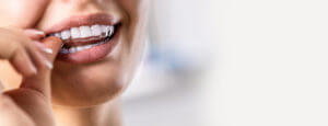A woman puts on invisible braces, also called teeth aligners, for teeth correction.