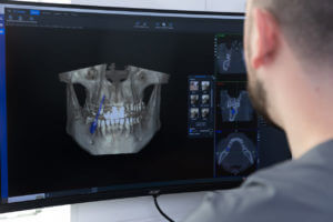 Detailed 3D Imaging of a Dental Structure on a Computer Screen.
