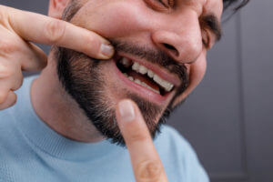 Man pointing at missing tooth.