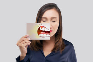 Image of a woman with tooth pain caused by Gum disease, or periodontal disease.