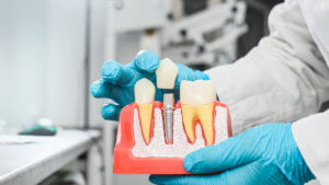 A dentist wearing sterile gloves holds an anatomical model with dental implants.